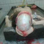 Brain extraction