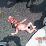 Crushed pregnant woman