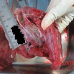 Dead pregnant anorexic