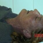 Dead woman in morgue