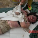 Drowned and bloated Thai woman