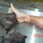 Female killed by lightning strike