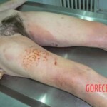 Female killed by lightning strike