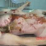 Female killed by lightning strike