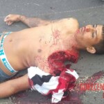 Guy nearly tore his shoulder