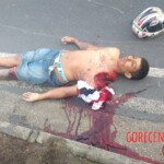 Guy nearly tore his shoulder