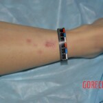 Initial examination of dead woman by forensic pathologists