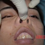 Initial examination of dead woman by forensic pathologists