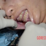 Initial examination of dead woman by forensic pathologists