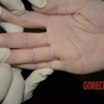 Initial examination of dead woman by forensic pathologists