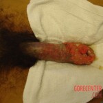 STD infected penis