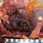 Woman murdered by son