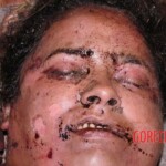 Murdered woman in forest