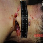 Nurse stabbed to death