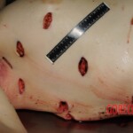 Nurse stabbed to death