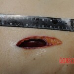 Nurse stabbed to death