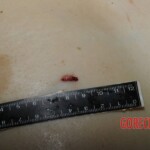 Nurse stabbed to death