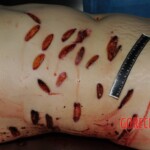 Nurse stabbed to death