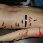 Nurse stabbed to death