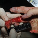 Nurse stabbed to death