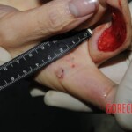 Nurse stabbed to death