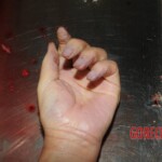 Nurse stabbed to death