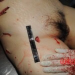 Nurse stabbed to death