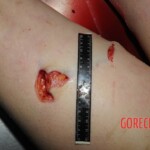 Nurse stabbed to death