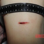 Nurse stabbed to death