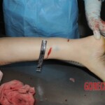 Nurse stabbed to death