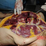 Nurse stabbed to death