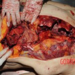 Nurse stabbed to death