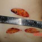 Chinese nurse stabbed to death