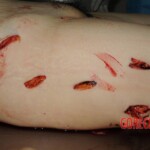 Chinese nurse stabbed to death