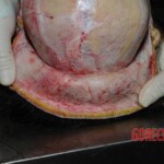 Chinese nurse stabbed to death