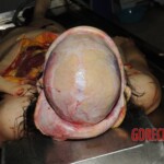 Chinese nurse stabbed to death