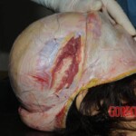 Chinese nurse stabbed to death