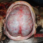 Chinese nurse stabbed to death