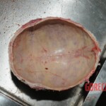 Chinese nurse stabbed to death