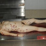 Nurse stabbed to death