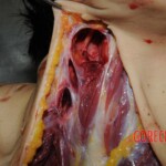 Chinese nurse stabbed to death