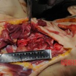 Chinese nurse stabbed to death