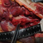 Chinese nurse stabbed to death