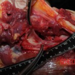 Chinese nurse stabbed to death