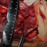 Chinese nurse stabbed to death