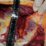 Chinese nurse stabbed to death