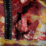 Chinese nurse stabbed to death