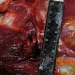 Chinese nurse stabbed to death