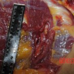 Chinese nurse stabbed to death