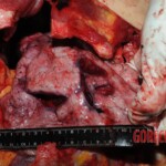 Chinese nurse stabbed to death